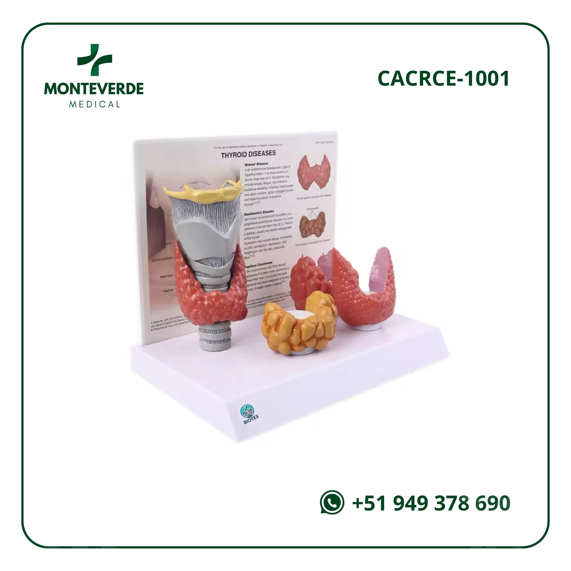 MAQUETA ANATÓMICO DE GLÁNDULA TIROIDES HUMANA