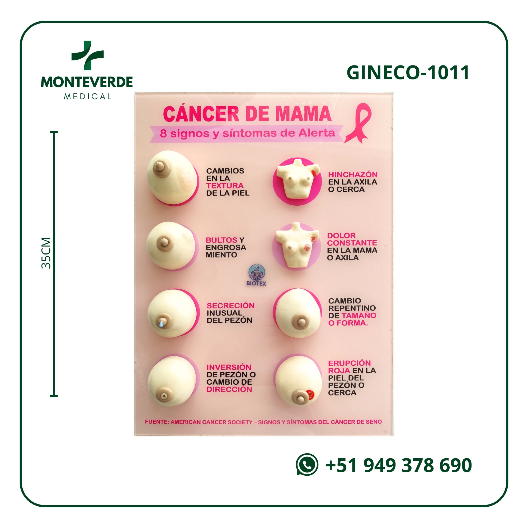 maqueta signos y sintomas de cancer de mama (1)