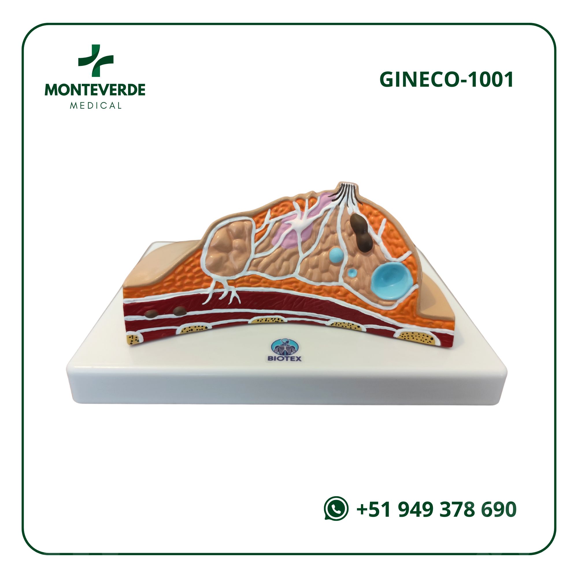 MAQUETA TRANSVERSAL DE MAMA CON CÁNCER Y PATOLOGÍAS