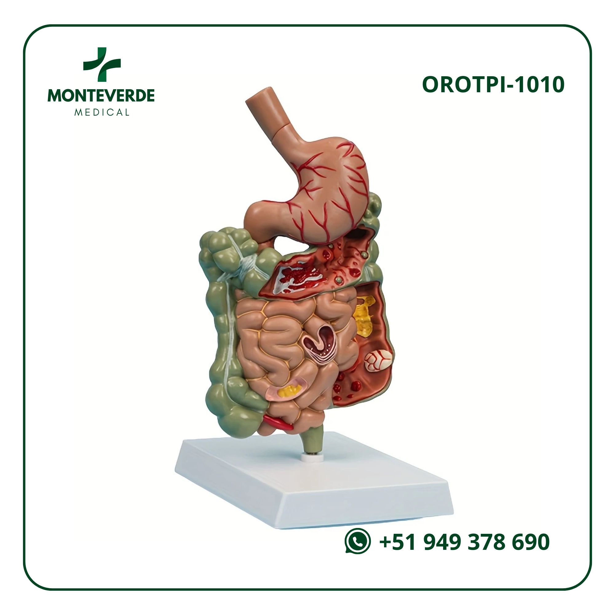 Maqueta Anatómica Removible del Estómago Humano con Sistema Digestivo (Intestino Delgado, Intestino Grueso y Recto)