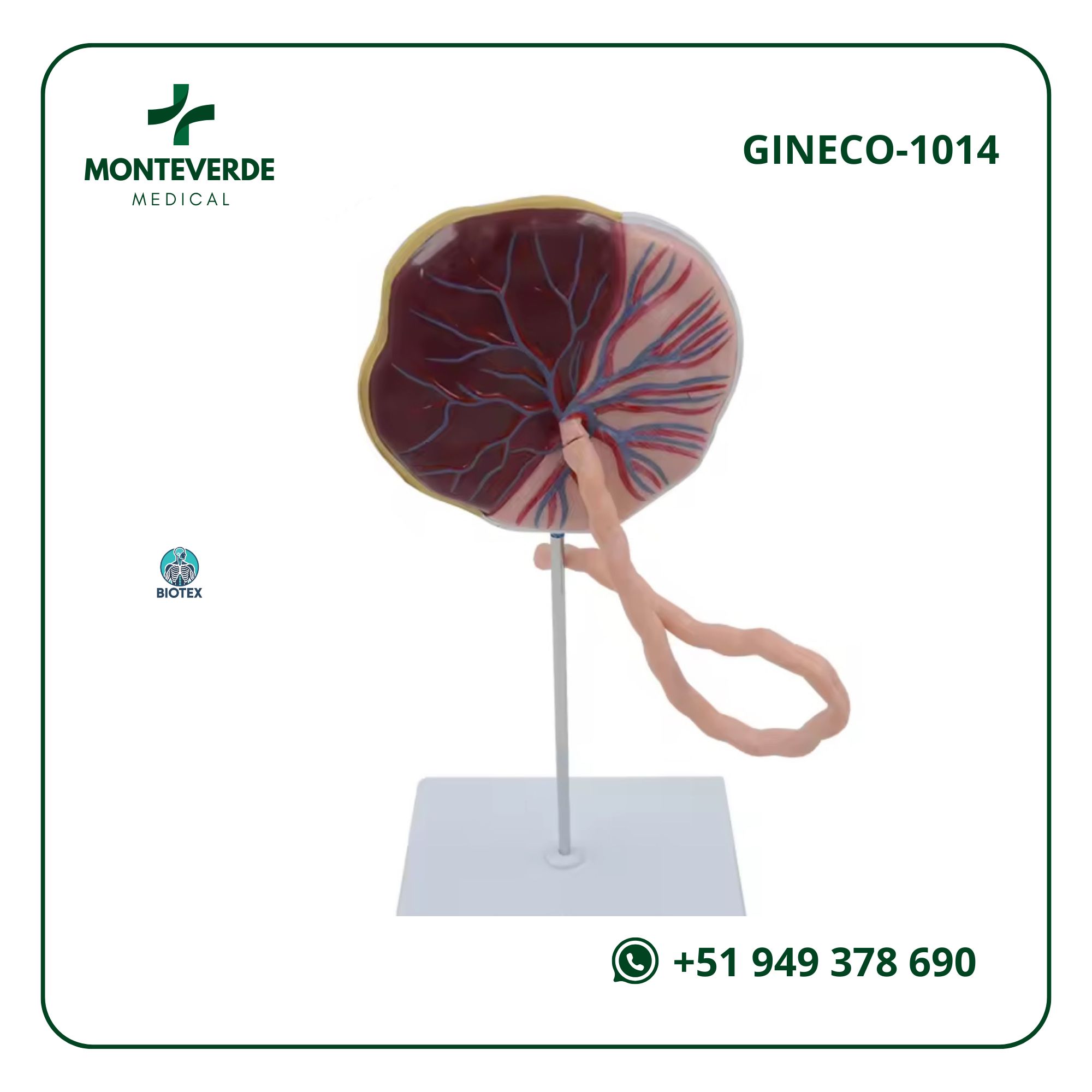 Maqueta anatómica de placenta