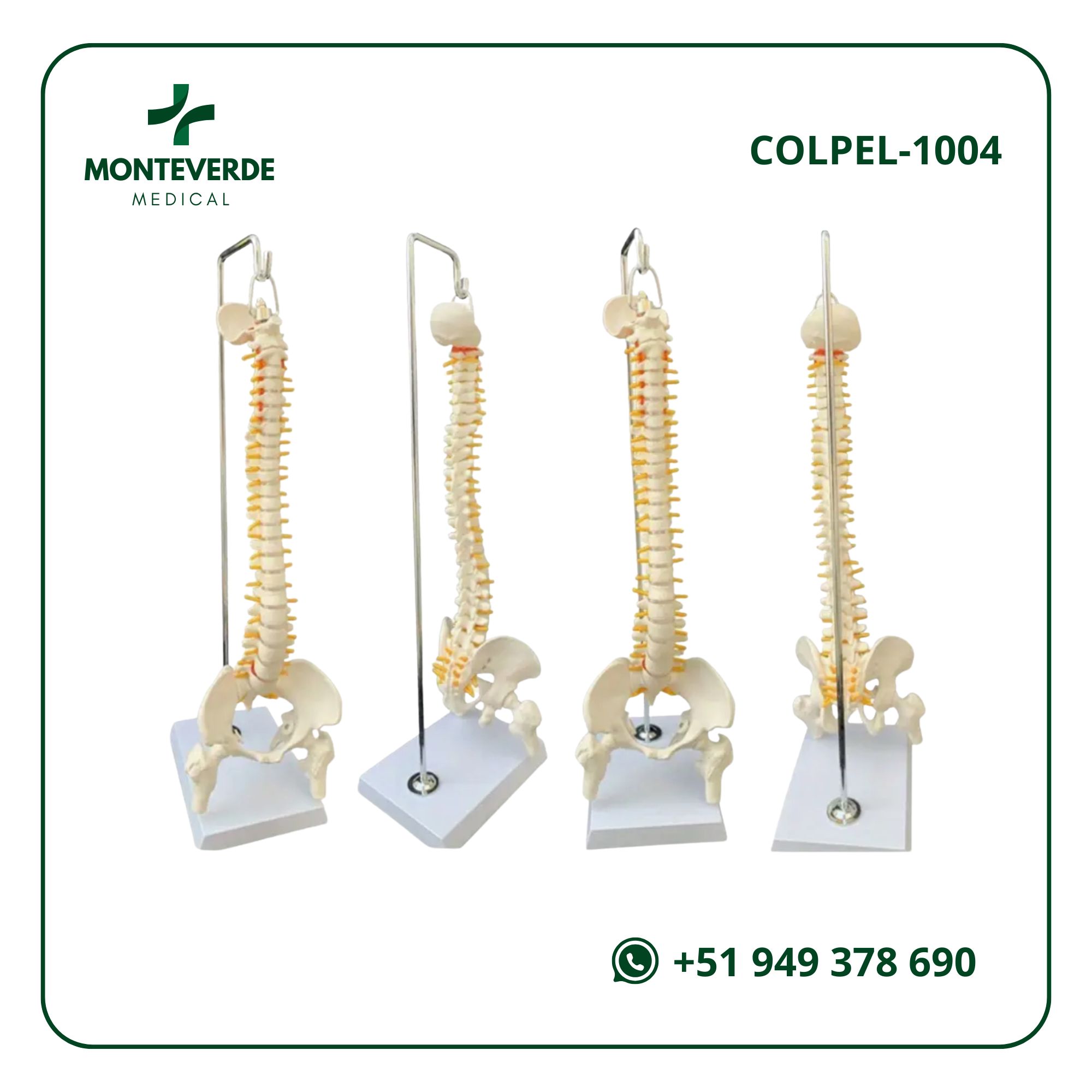 Maqueta Demostrativa del Progreso de Osteoporosis