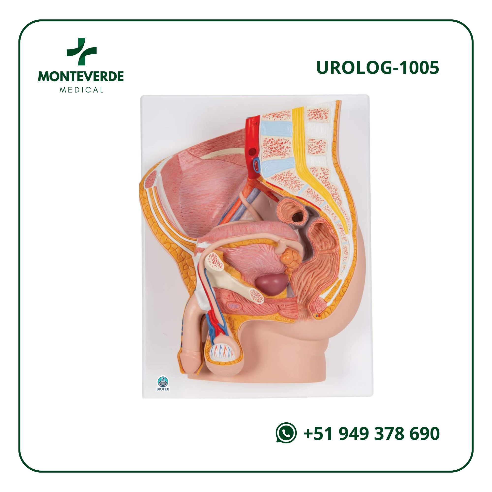 MAQUETA DE PELVIS MASCULINA CON PATOLOGÍA DE HIPERPLASIA PROSTÁTICA BENIGNA EN SECCIÓN SAGITAL