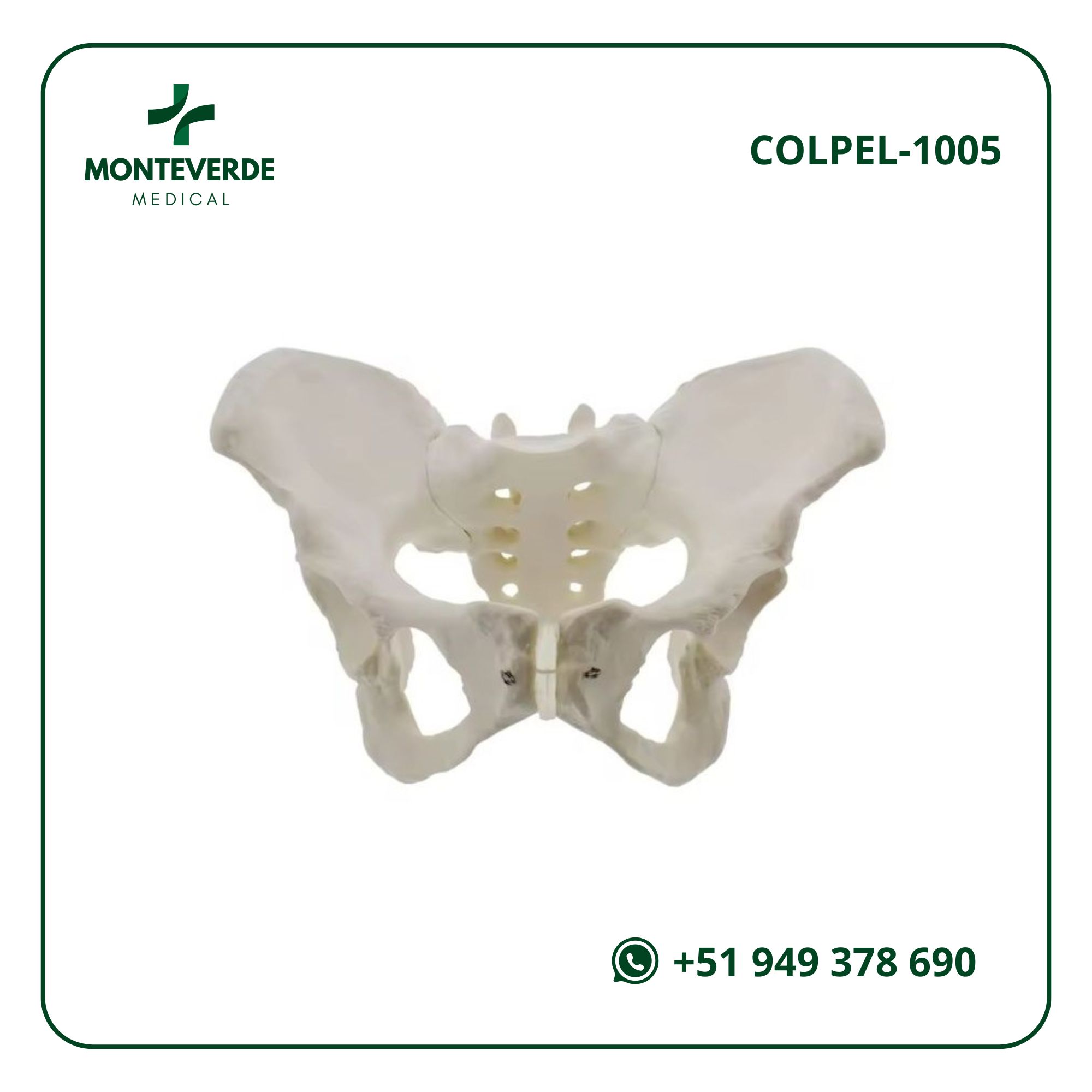 Maqueta Demostrativa del Progreso de Osteoporosis (3)