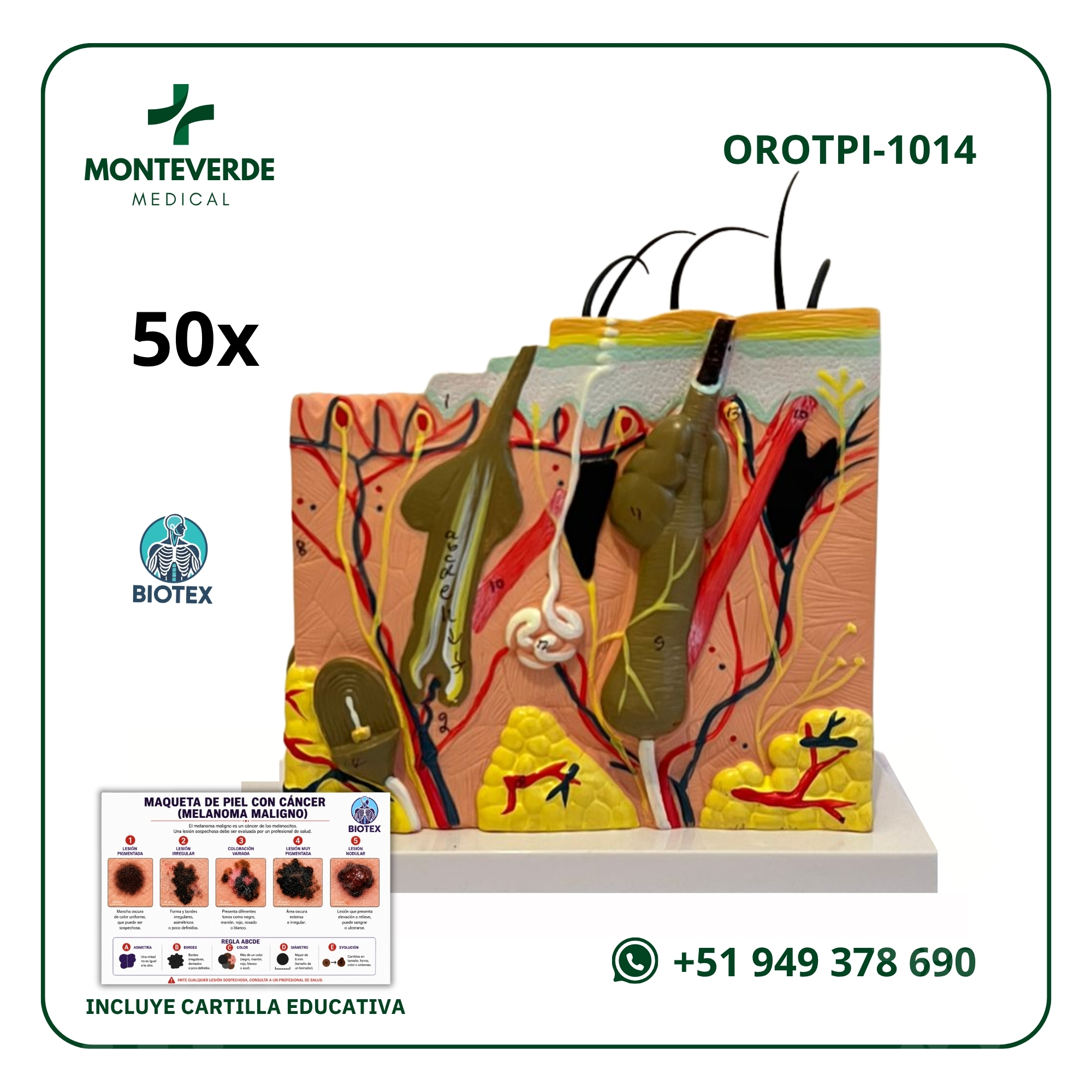 Maqueta de piel humana con cancer 50 x